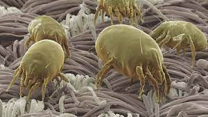 How To Prevent Your Home From Becoming A Dust Mite City Feeding Ground!
