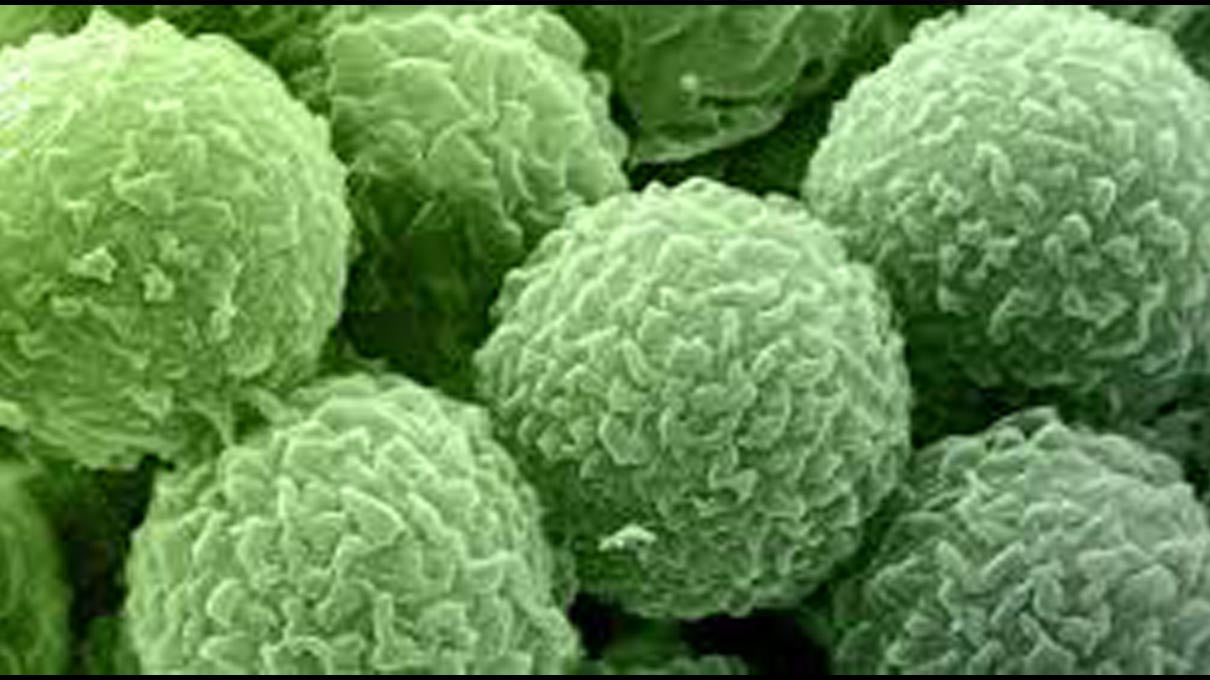 Best HEPA Air Purifier For Destroying Airborne Viruses.